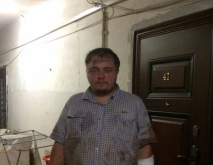 Российского ДиКаприо покусал наркоман