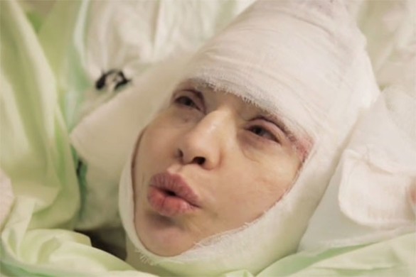 52-летняя Алиса Мон увеличила грудь ради возвращения на сцену