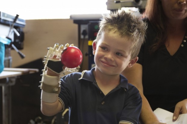 Robohand протез, распечатанный на 3D принтере